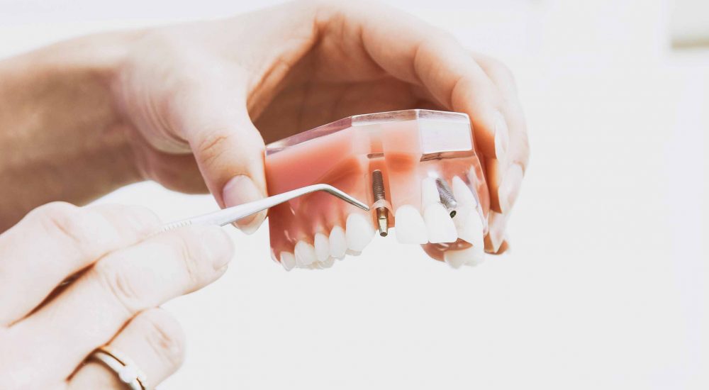 Trattamenti di odontoiatria