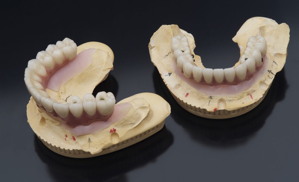 Protesi Dentarie e dentiere fisse o mobili