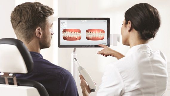 Impronta dentale digitale a Moncalieri